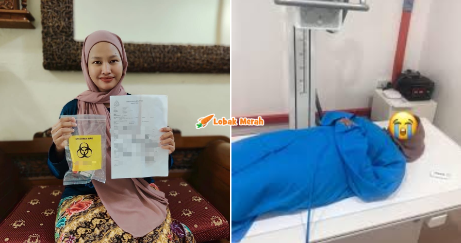 Wanita Jadi Mangsa Kecuaian Doktor Salah Pasang IUCD, JKNJ Tubuh Jawatankuasa Khas Untuk Siasatan