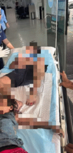 Cedera Dalam Kebakaran