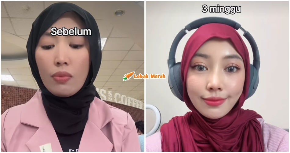Kim Seri Tayang Wajah Sebelum & Selepas ‘Buat Muka’, Bagi Peluang Netizen Untuk Membawang