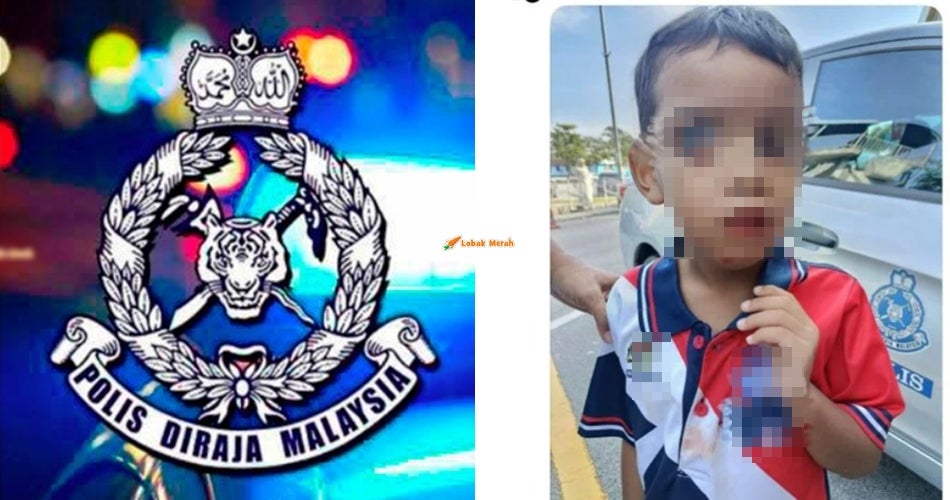 Murid Tahun 1 Ditemui Dalam Keadaan Cedera Dalam Tandas Sekolah, Dakwa Dipukul Oleh Guru Besar