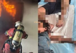 Mangsa Cedera Kebakaran