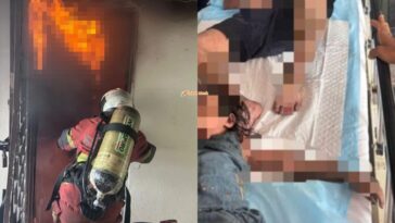 Mangsa Cedera Kebakaran