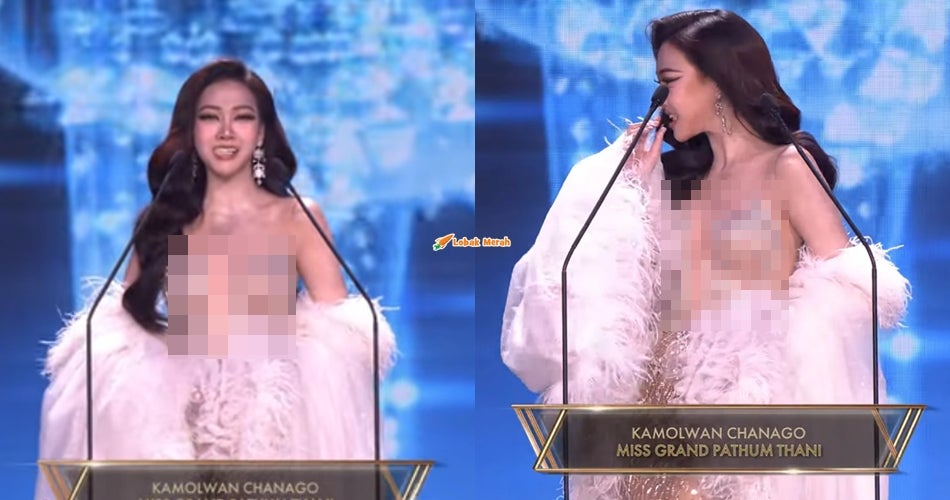 Peserta Miss Grand Thailand Jadi Tumpuan Ramai Gara-gara Veneer Gigi Tercabut Ketika Pertandingan