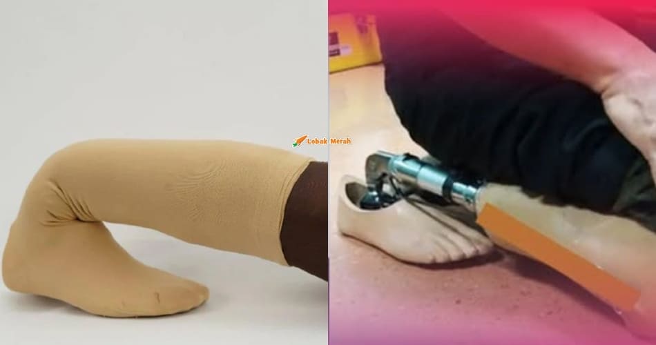 Pakar Ortopedik Tempatan Berjaya Cipta Kaki Palsu Mesra Solat Pertama Di Dunia