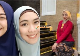 Ria Ricis Hidung