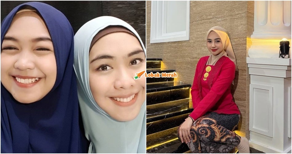“Kakak dia ustazah” – Netizen Perasan Perubahan Ketara Pada Wajah, Ria Ricis Mengaku ‘Operate’ Hidung