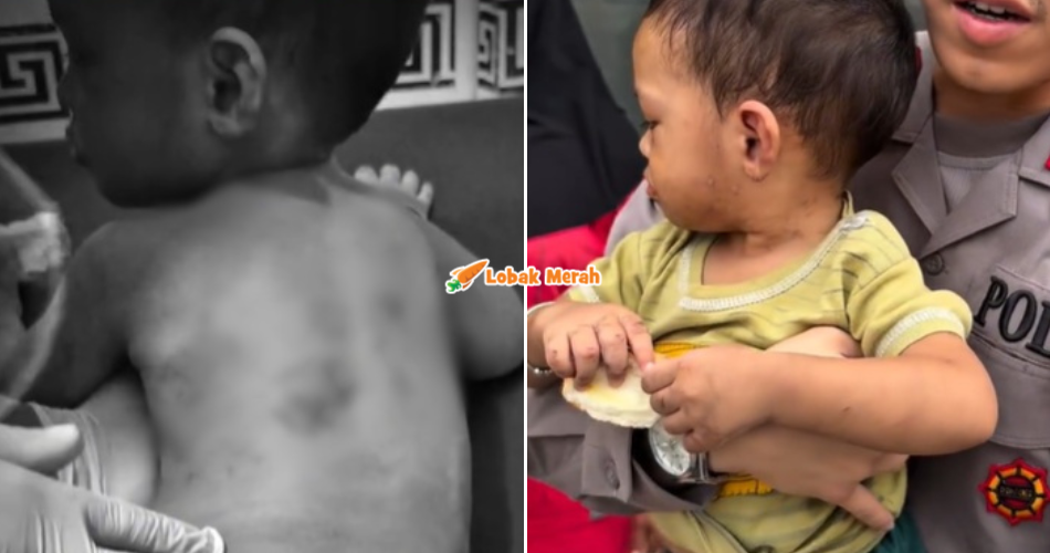 Tergamak C*cuh R*kok & Siram Air Panas, Bapa Durjana Ditahan Dera Anak Kandung Berusia 2 Tahun