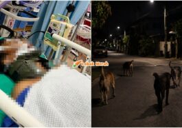 Dikejar Anjing Koma Cedera Otak Kekal