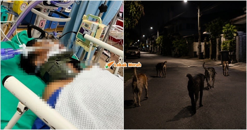 Penunggang Motosikal Koma Seminggu Selepas Dikejar Anjing Liar Mungkin Alami Kecederaan Otak Kekal